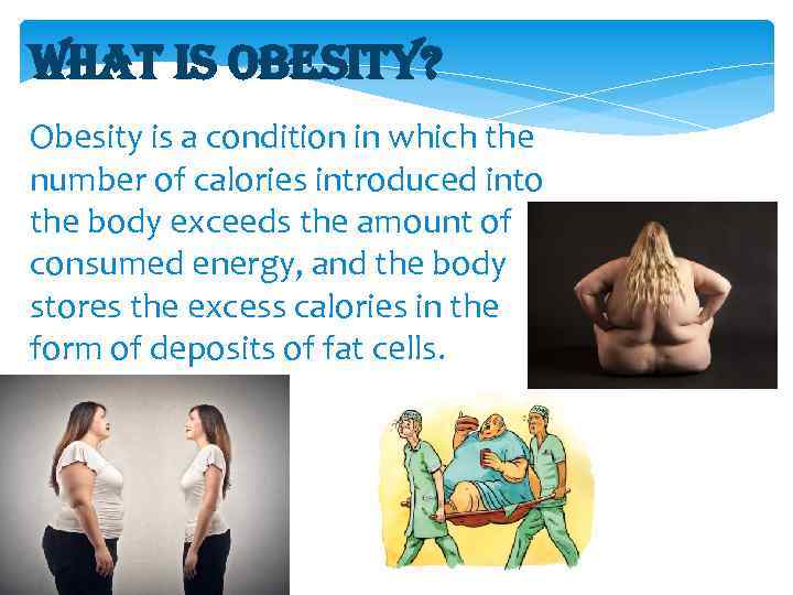 What is obesity? Obesity is a condition in which the number of calories introduced