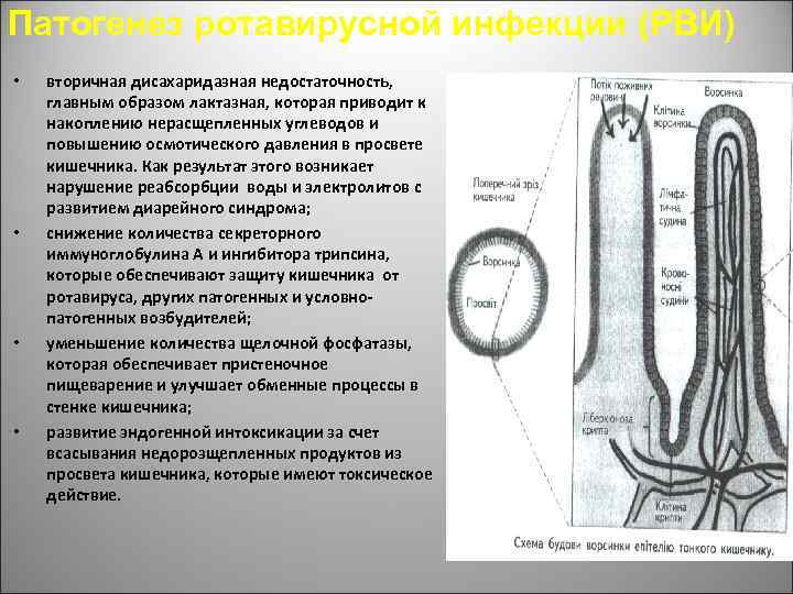 Патогенез ротавирусной инфекции (РВИ) • • вторичная дисахаридазная недостаточность, главным образом лактазная, которая приводит