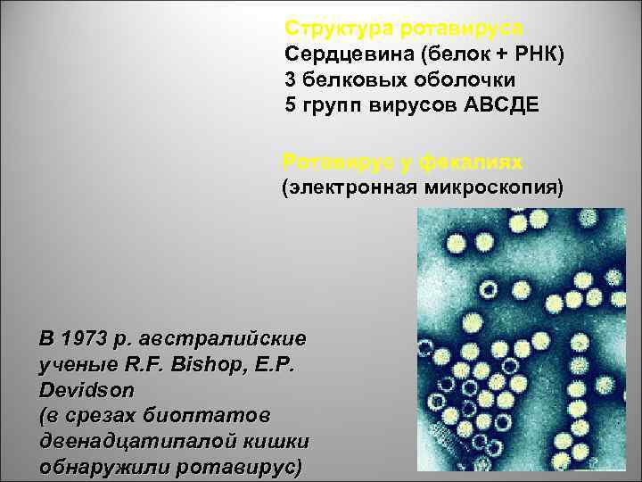 Структура ротавируса Сердцевина (белок + РНК) 3 белковых оболочки 5 групп вирусов АВСДЕ Ротавирус