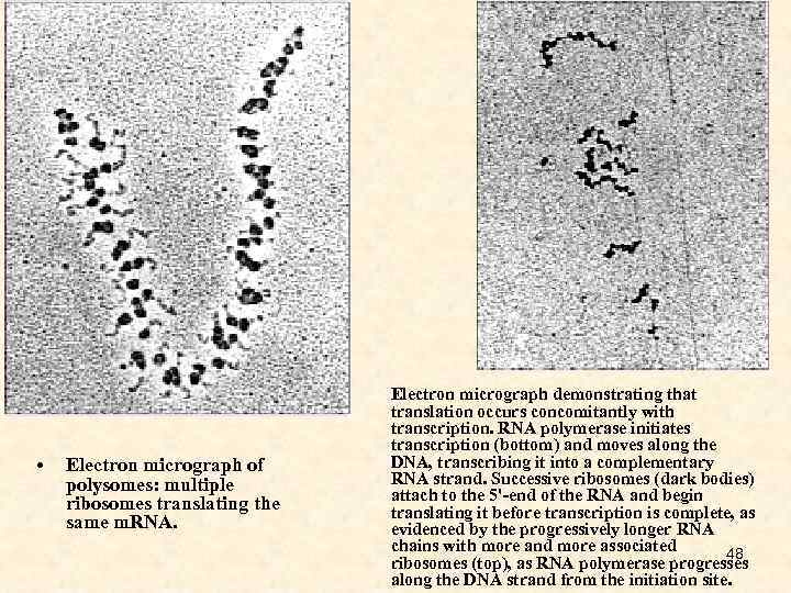  • Electron micrograph of polysomes: multiple ribosomes translating the same m. RNA. Electron