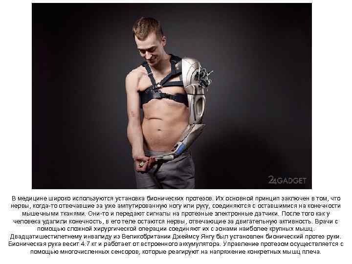 В медицине широко используются установка бионических протезов. Их основной принцип заключен в том, что