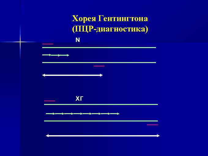 Хорея Гентингтона (ПЦР-диагностика) N ХГ 