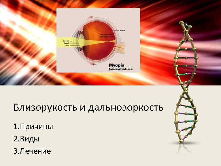 Близорукость и дальнозоркость 1. Причины 2. Виды 3. Лечение 