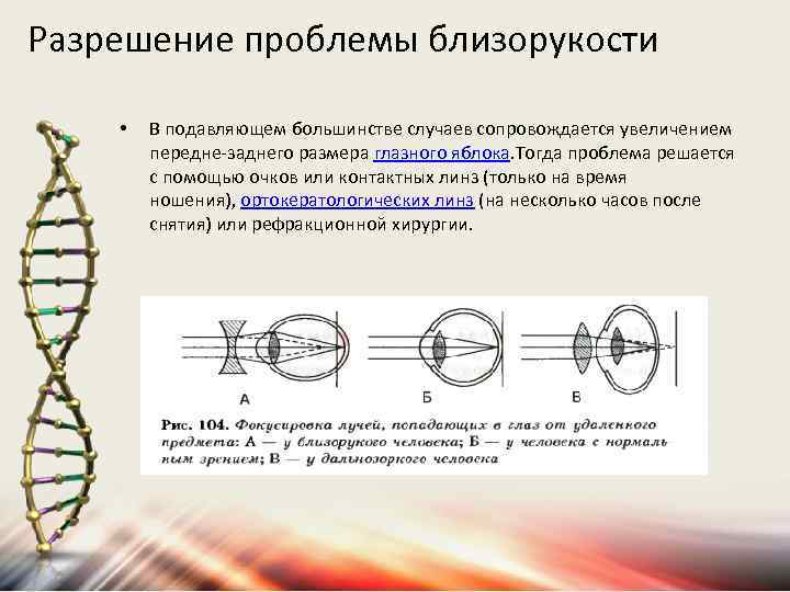 Разрешение проблемы близорукости • В подавляющем большинстве случаев сопровождается увеличением передне-заднего размера глазного яблока.