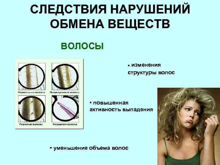 СЛЕДСТВИЯ НАРУШЕНИЙ ОБМЕНА ВЕЩЕСТВ ВОЛОСЫ изменения структуры волос l • повышенная активность выпадения •