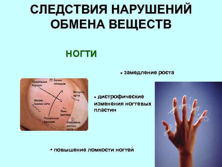 СЛЕДСТВИЯ НАРУШЕНИЙ ОБМЕНА ВЕЩЕСТВ НОГТИ l замедление роста дистрофические изменения ногтевых пластин l •