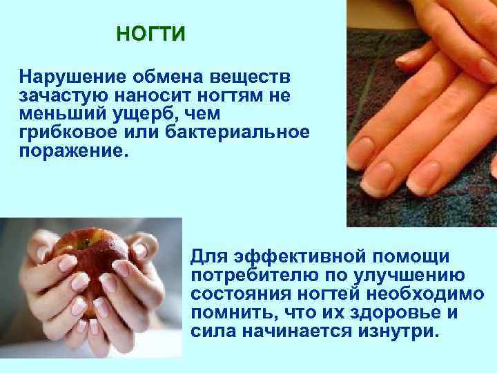 НОГТИ Нарушение обмена веществ зачастую наносит ногтям не меньший ущерб, чем грибковое или бактериальное