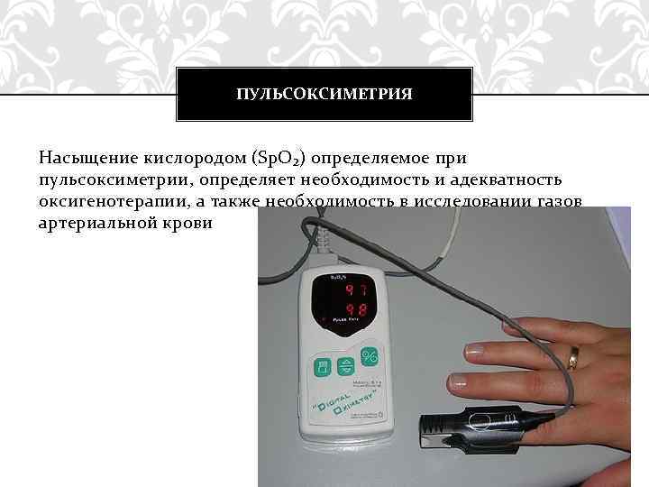 ПУЛЬСОКСИМЕТРИЯ Насыщение кислородом (Sp. O₂) определяемое при пульсоксиметрии, определяет необходимость и адекватность оксигенотерапии, а