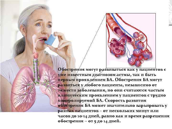 Обострения могут развиваться как у пациентов с уже известным диагнозом астмы, так и быть