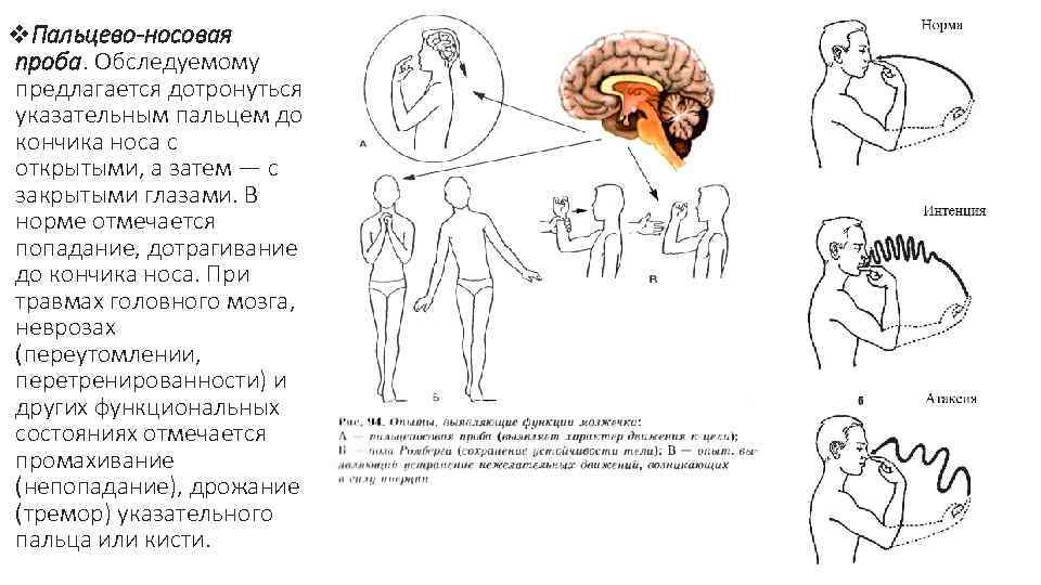 Составь верную схему функционального деления нервной системы человека определи какими цифрами