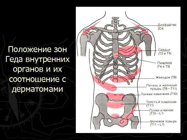 Положение зон Геда внутренних органов и их соотношение с дерматомами 