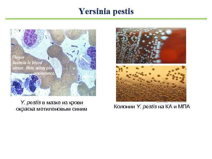 Yersinia pestis Y. pestis в мазке из крови окраска метиленовым синим Колонии Y. pestis