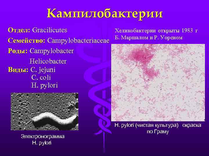 Холерный вибрион фото под микроскопом