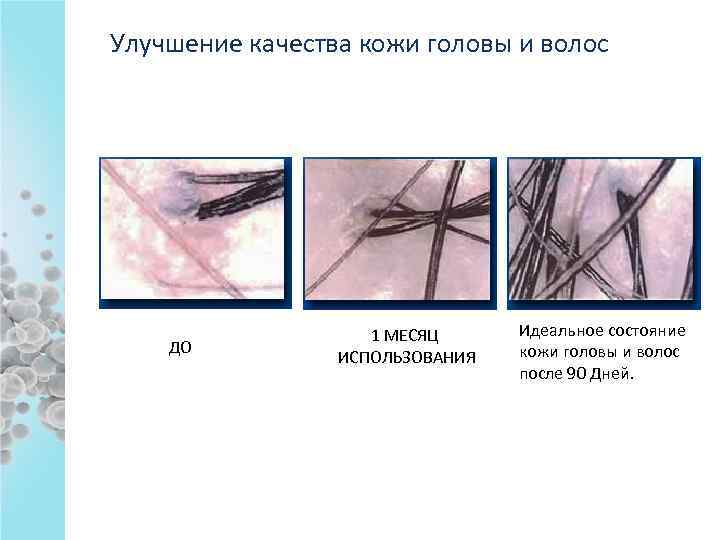 Улучшение качества кожи головы и волос ДО 1 МЕСЯЦ ИСПОЛЬЗОВАНИЯ Идеальное состояние кожи головы