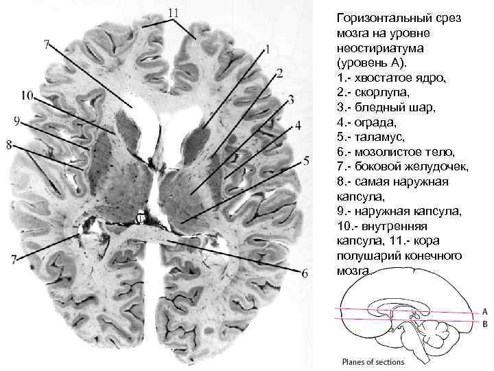 Горизонтальный срез мозга на уровне неостириатума (уровень А). 1. - хвостатое ядро, 2. -