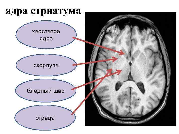 ядра стриатума хвостатое ядро скорлупа бледный шар ограда 