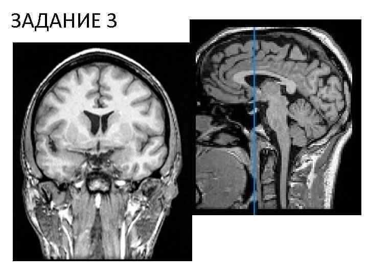 ЗАДАНИЕ 3 