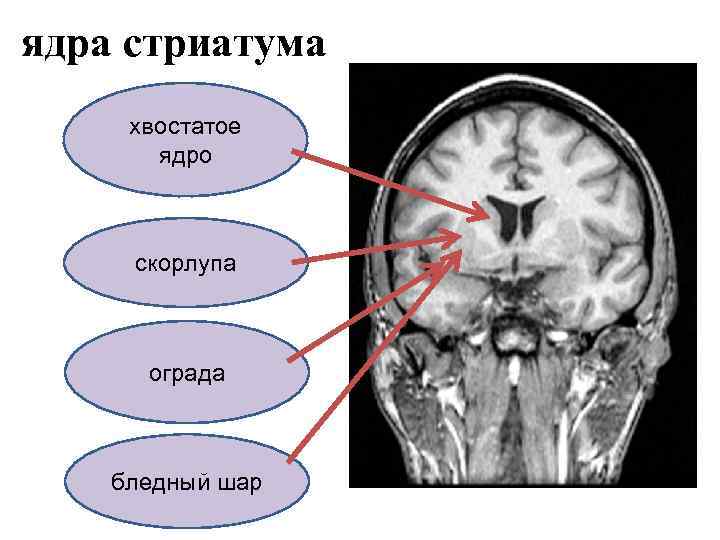 ядра стриатума хвостатое ядро скорлупа ограда бледный шар 