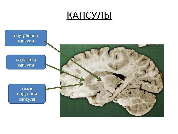 КАПСУЛЫ внутренняя капсула наружная капсула самая наружная капсула 