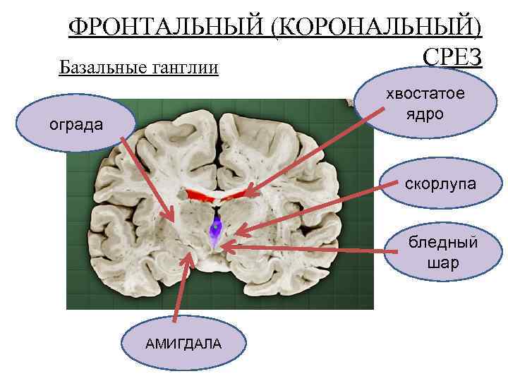 ФРОНТАЛЬНЫЙ (КОРОНАЛЬНЫЙ) СРЕЗ Базальные ганглии хвостатое ядро ограда скорлупа бледный шар АМИГДАЛА 