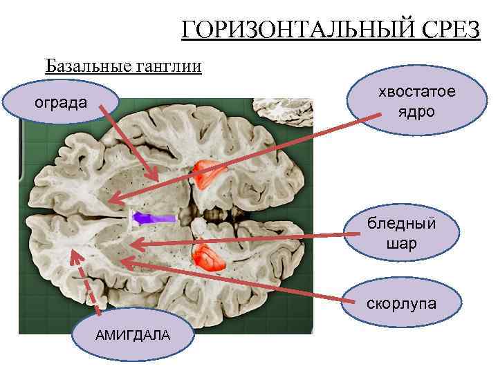 ГОРИЗОНТАЛЬНЫЙ СРЕЗ Базальные ганглии хвостатое ядро ограда бледный шар скорлупа АМИГДАЛА 