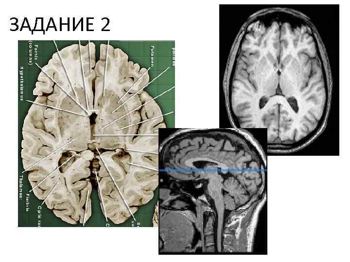 ЗАДАНИЕ 2 