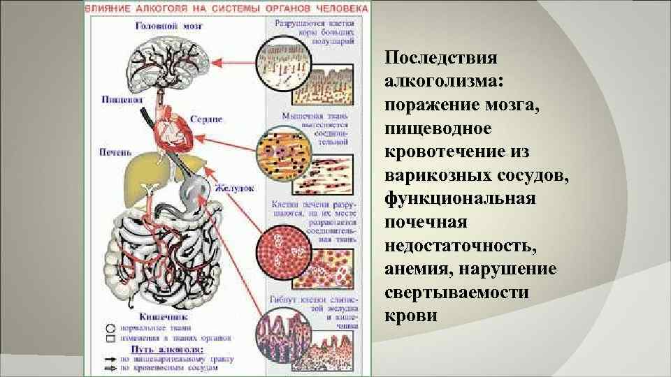 Последствия алкоголизма: поражение мозга, пищеводное кровотечение из варикозных сосудов, функциональная почечная недостаточность, анемия, нарушение