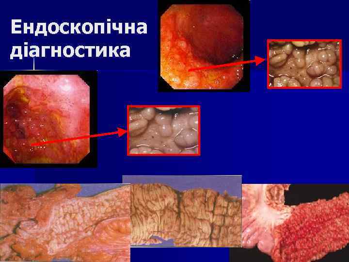 Ендоскопічна діагностика 