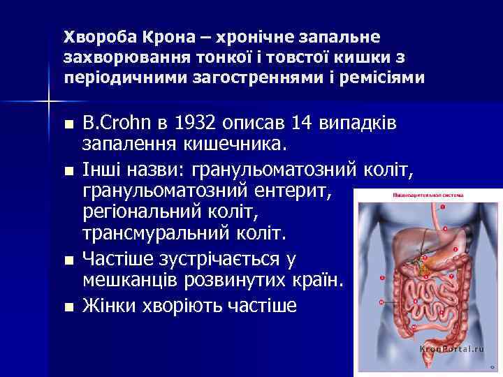 Хвороба Крона – хронічне запальне захворювання тонкої і товстої кишки з періодичними загостреннями і