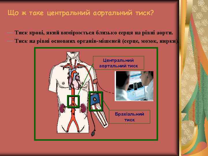 Що ж таке центральний аортальний тиск? — Тиск крові, який вимірюється близько серця на