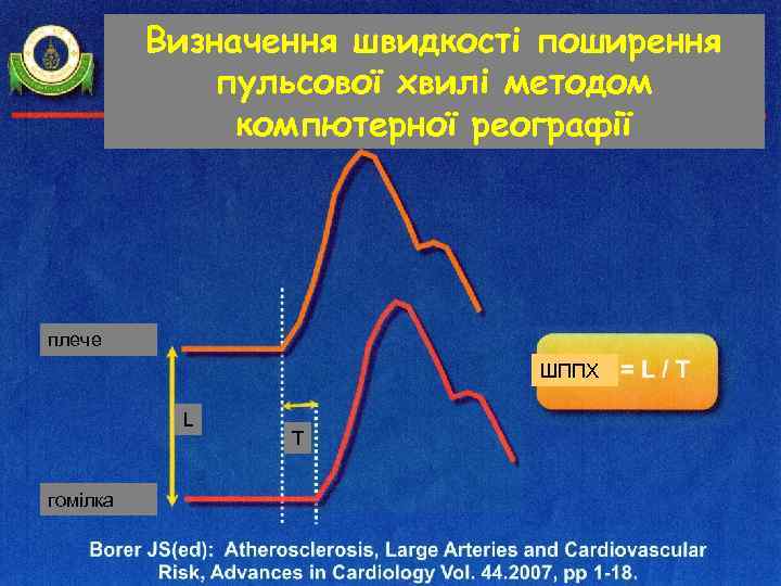 Визначення швидкості поширення пульсової хвилі методом компютерної реографії плече ШППХ L гомілка Т 