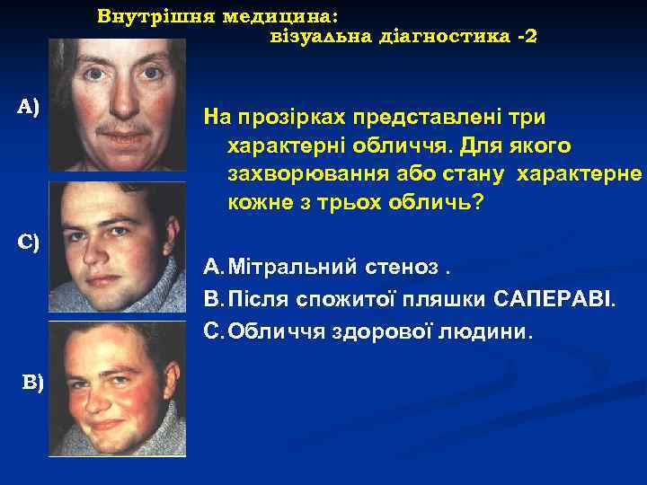 Внутрішня медицина: візуальна діагностика -2 А) С) В) На прозірках представлені три характерні обличчя.