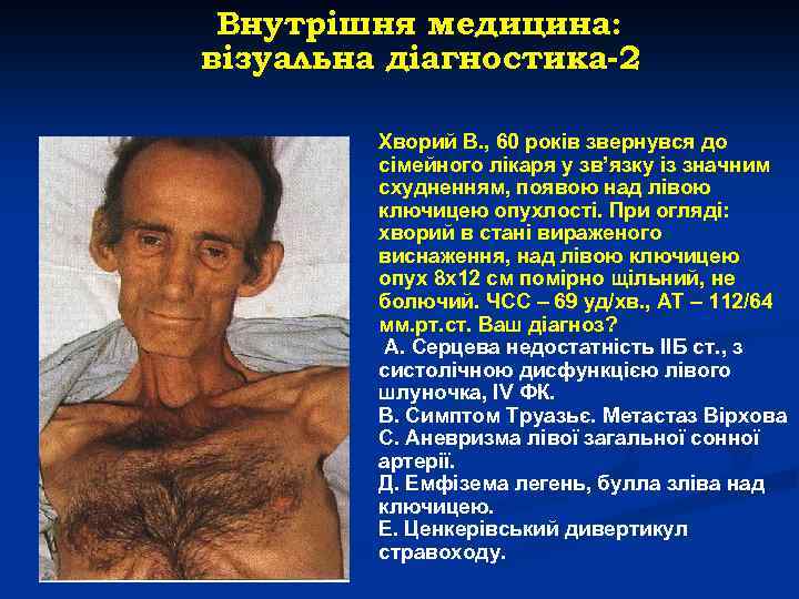 Внутрішня медицина: візуальна діагностика-2 Хворий В. , 60 років звернувся до сімейного лікаря у