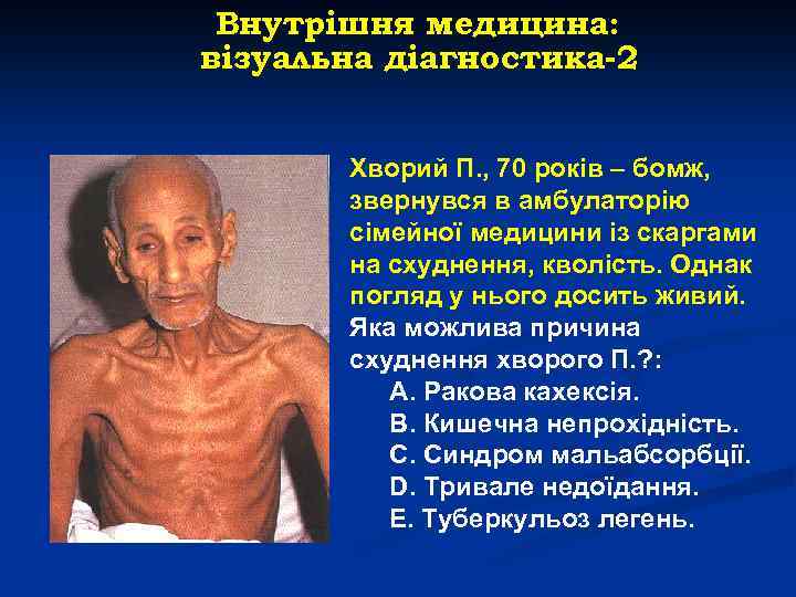 Внутрішня медицина: візуальна діагностика-2 Хворий П. , 70 років – бомж, звернувся в амбулаторію