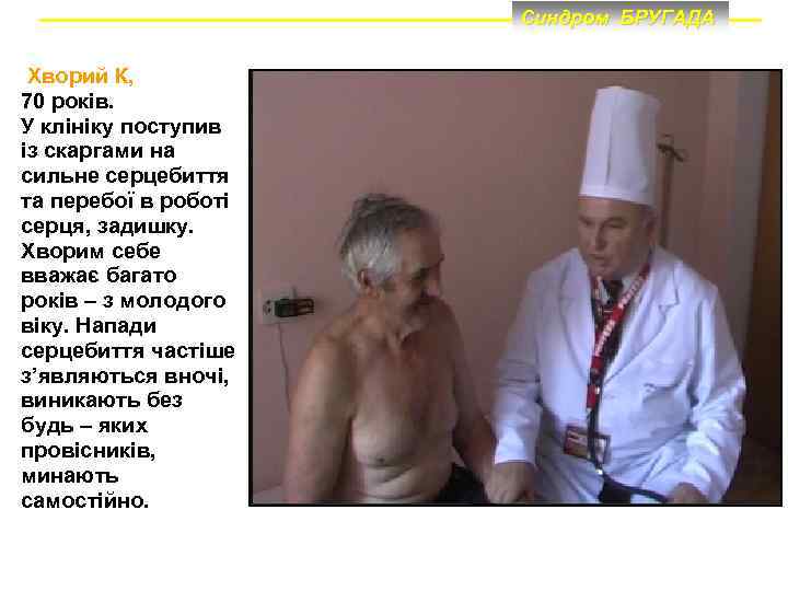 Синдром БРУГАДА Хворий К, 70 років. У клініку поступив із скаргами на сильне серцебиття
