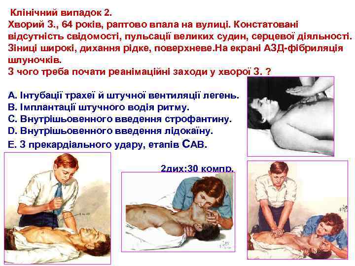  Клінічний випадок 2. Хворий З. , 64 років, раптово впала на вулиці. Констатовані