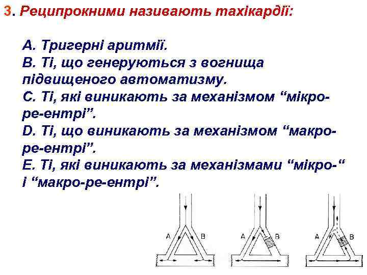 3. Реципрокними називають тахікардії: А. Тригерні аритмії. В. Ті, що генеруються з вогнища підвищеного