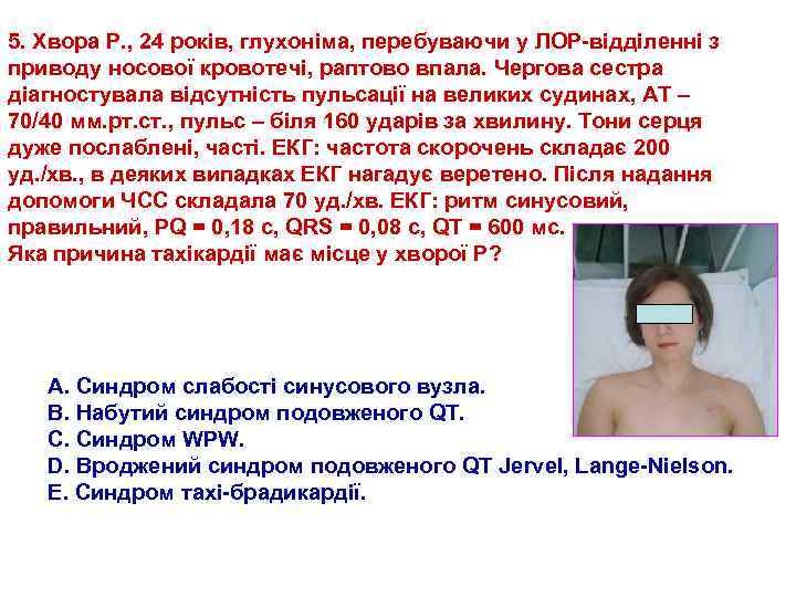 5. Хвора Р. , 24 років, глухоніма, перебуваючи у ЛОР відділенні з приводу носової