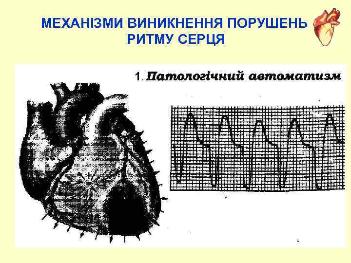 МЕХАНІЗМИ ВИНИКНЕННЯ ПОРУШЕНЬ РИТМУ СЕРЦЯ 1. 