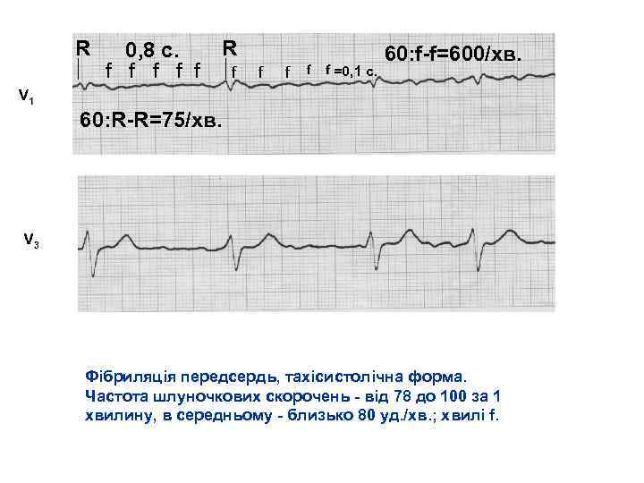R 0, 8 с. f f f R f f f =0, 1 c.