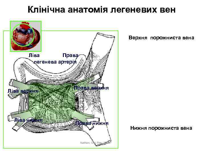 Клінічна анатомія легеневих вен Верхня порожниста вена Права Ліва легенева артерія Ліва верхня Ліва