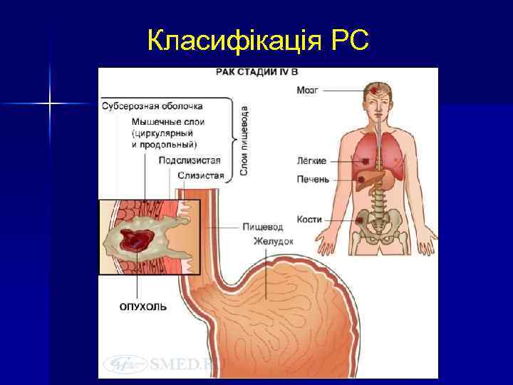 Класифікація РС 