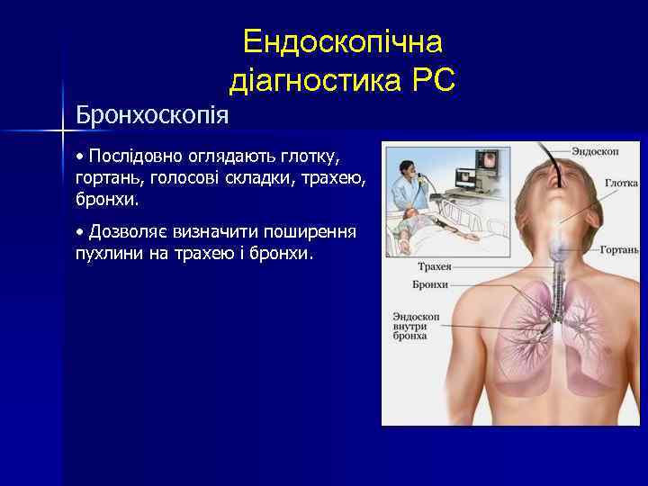 Бронхоскопія Ендоскопічна діагностика РС • Послідовно оглядають глотку, гортань, голосові складки, трахею, бронхи. •