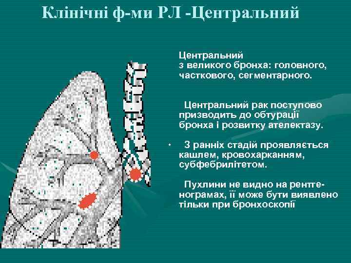 Клінічні ф-ми РЛ -Центральний з великого бронха: головного, часткового, сегментарного. Центральний рак поступово призводить