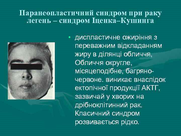 Паранеопластичний синдром при раку легень – синдром Іценка–Кушинга • диспластичне ожиріння з переважним відкладанням