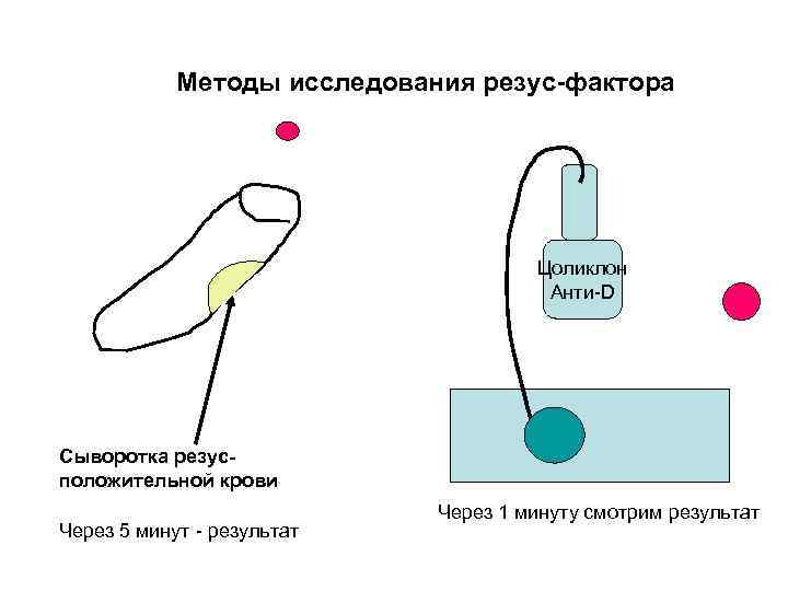 Методы исследования резус-фактора Цоликлон Анти-D Сыворотка резусположительной крови Через 5 минут - результат Через