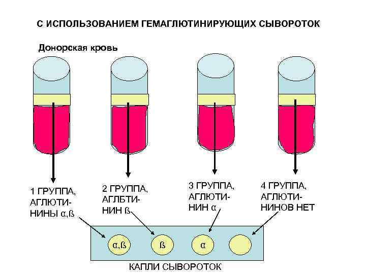 С ИСПОЛЬЗОВАНИЕМ ГЕМАГЛЮТИНИРУЮЩИХ СЫВОРОТОК Донорская кровь 1 ГРУППА, АГЛЮТИНИНЫ α, ß 3 ГРУППА, АГЛЮТИНИН