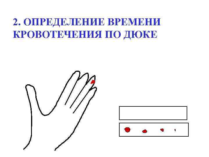 2. ОПРЕДЕЛЕНИЕ ВРЕМЕНИ КРОВОТЕЧЕНИЯ ПО ДЮКЕ 