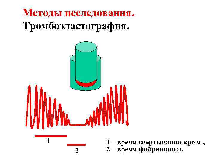 Методы исследования. Тромбоэластография. 1 2 1 – время свертывания крови, 2 – время фибринолиза.