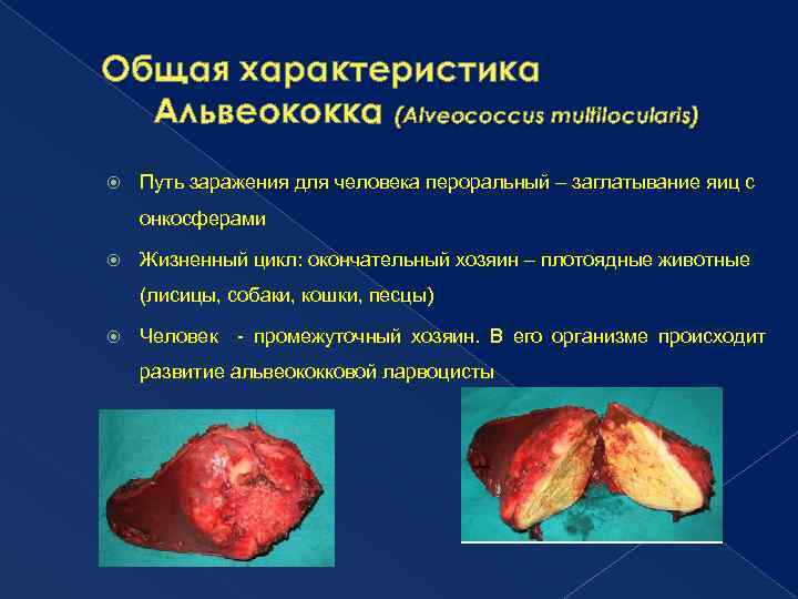 Общая характеристика Альвеококка (Alveococcus multilocularis) Путь заражения для человека пероральный – заглатывание яиц с